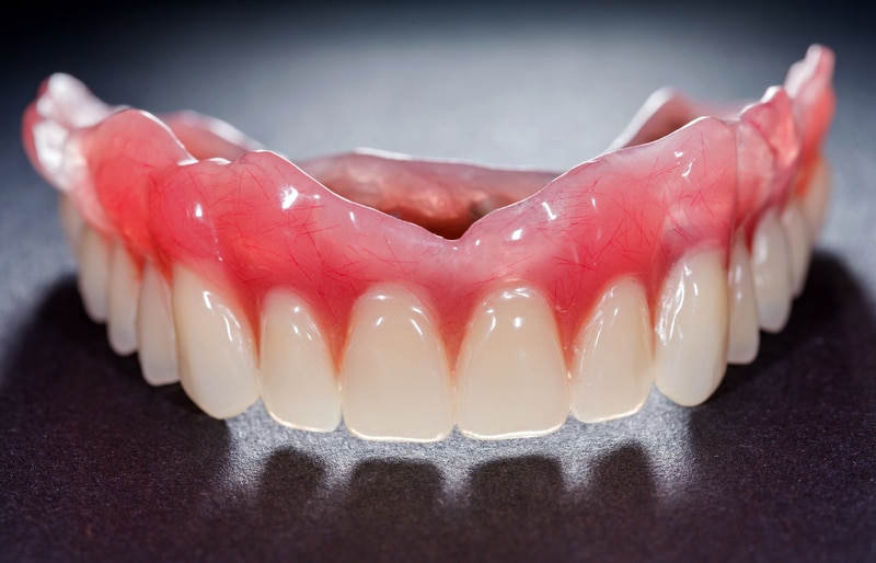 Close up image of dentures of the upper jaw