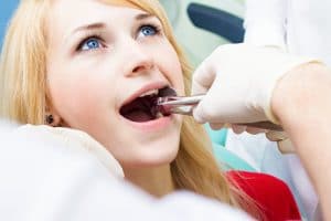 Young woman at the dentist office having a tooth pulled.