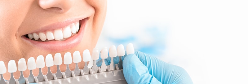 Woman getting teeth color options for teeth whitening by dentist.