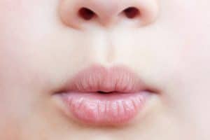 Child pursing lips that are cracked and dry from xerostomia