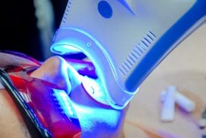 Woman sitting in dentist chair receiving a teeth whitening treatment with an LED light.