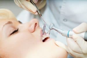 Up close view of a dental patient having her teeth cleaned by a hygienist.