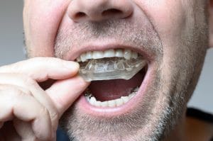 Man placing a night guard in his mouth to prevent teeth grinding
