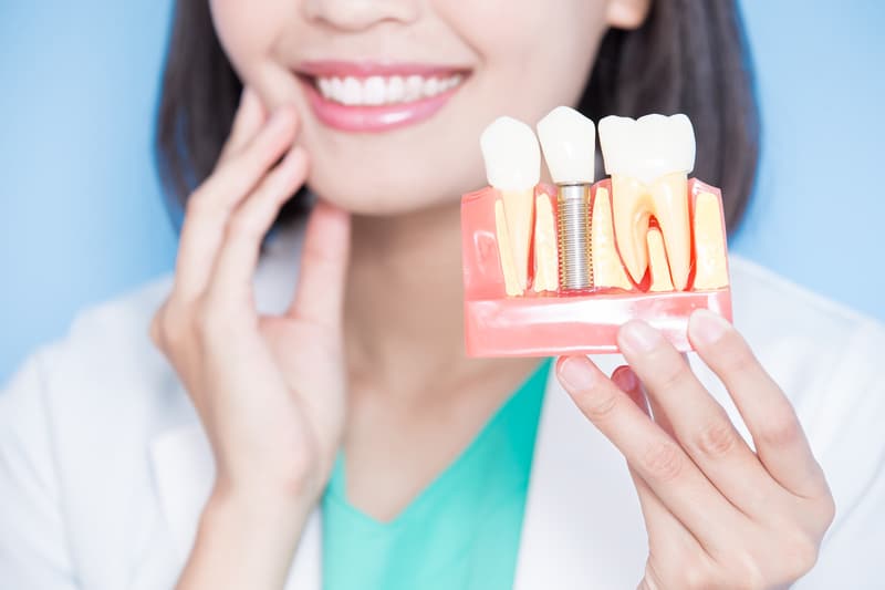 Woman dentist holding examples of what a normal tooth and a dental implant look like.